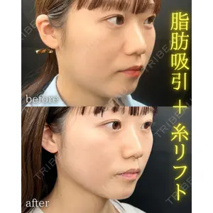 THE FIRST CLINIC 町田院 木暮 啓一郎医師の症例
