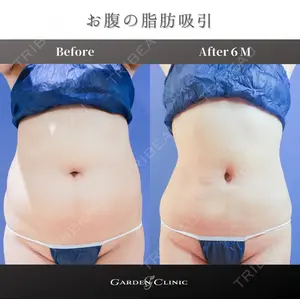 ガーデンクリニック 池袋院の症例
