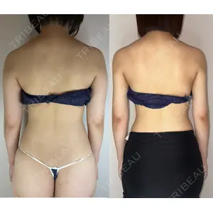 GAYA body design clinic 飯ヶ谷 重来医師の症例