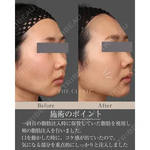 THE CLINIC（ザ・クリニック） 東京院 帯包 雄次郎医師の症例