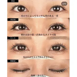 湘南美容クリニック 大阪梅田院 横谷 仁彦医師の症例