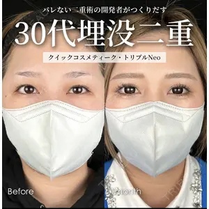 湘南美容クリニック 大阪梅田院 横谷 仁彦医師の症例