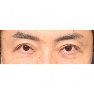 プリモ麻布十番クリニック 大場教弘医師の症例
