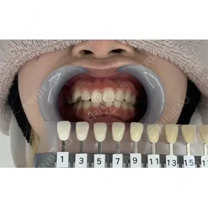 DENTAL ALIEN 衛生士１医師の症例