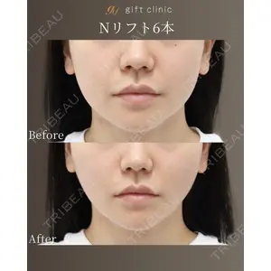 gift clinic 能登谷 翔医師の症例