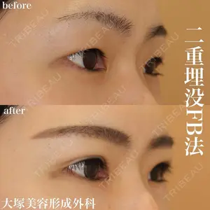 大塚美容形成外科 銀座本院 石井秀典医師の症例