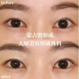 大塚美容形成外科 銀座本院 石井秀典医師の症例