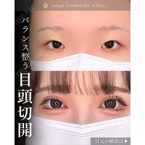 東京シンデレラ美容外科 新宿院 吉原 伯医師の症例