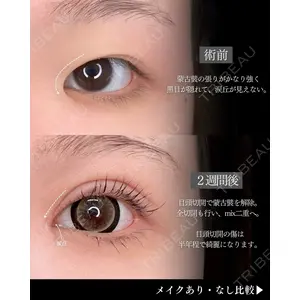 東京シンデレラ美容外科 新宿院 吉原 伯医師の症例