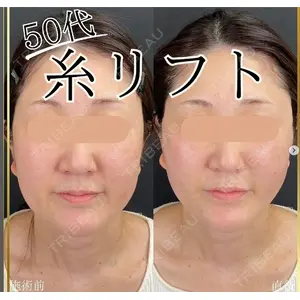 自由が丘ウェルエイジングビューティークリニックの症例