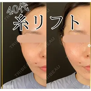 自由が丘ウェルエイジングビューティークリニックの症例
