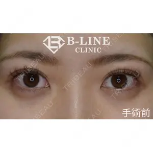 B-LINE CLINIC 池袋院 小池 康弘医師の症例