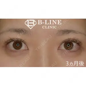 B-LINE CLINIC 池袋院 小池 康弘医師の症例