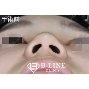 B-LINE CLINIC 池袋院 小池 康弘医師の症例