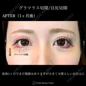Code Beauty Clinic 名古屋院 橋本 祥平医師の症例