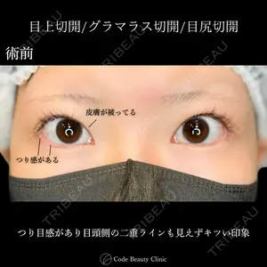 Code Beauty Clinic 名古屋院 橋本 祥平医師の症例