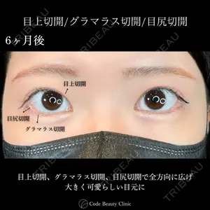 Code Beauty Clinic 名古屋院 橋本 祥平医師の症例