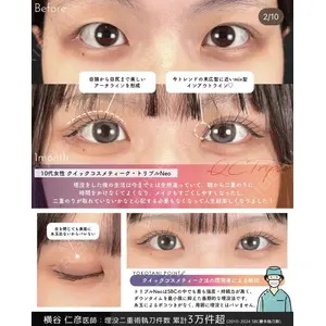 湘南美容クリニック 大阪梅田院 横谷 仁彦医師の症例