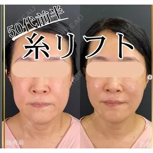 自由が丘ウェルエイジングビューティークリニックの症例