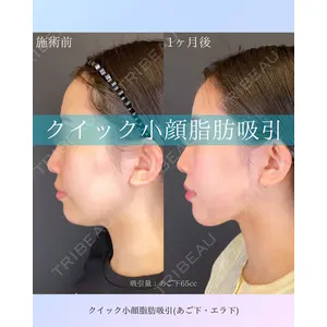 ルラ美容クリニック 札幌院 佐藤 雄紀医師の症例