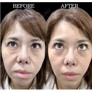 ルラ美容クリニック 高田馬場院 若佐 卓矢医師の症例