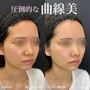 ルラ美容クリニック 名古屋栄院 / ルラスキンクリニック 名古屋栄院 関戸 優医師の症例