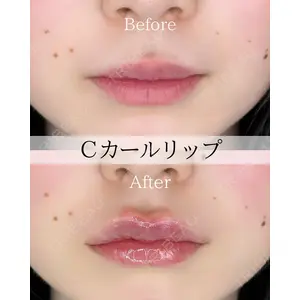 ルラ美容クリニック 広島院の症例