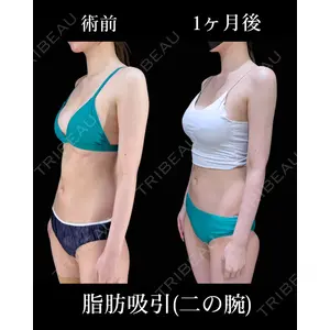 HAAB×DREAM BEAUTY CLINIC 東京本院 吉岡 修一医師の症例