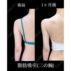 HAAB×DREAM BEAUTY CLINIC 東京本院 吉岡 修一医師の症例