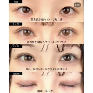 湘南美容クリニック 大阪梅田院 横谷 仁彦医師の症例