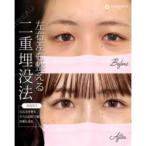 東京形成美容外科 船橋院 弓削田　浩主医師の症例