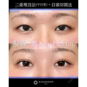 東京形成美容外科 船橋院 山崎 修吾医師の症例