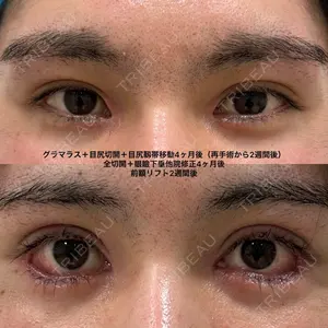 エターナル美容クリニックの症例