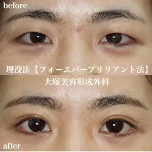 大塚美容形成外科 札幌院の症例