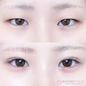 仙台N美容クリニック 小阪 捺稀医師の症例