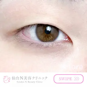 仙台N美容クリニック 小阪 捺稀医師の症例