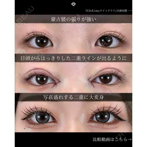 TCB東京中央美容外科 松山院の症例