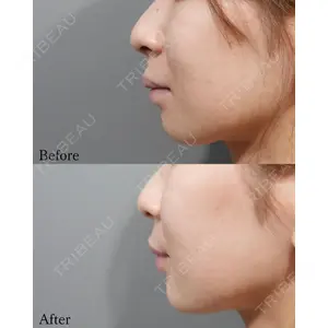 L‘amour clinic Tokyo【ラムールクリニック東京】の症例