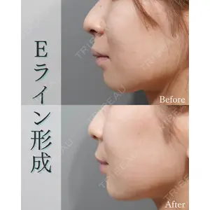 L‘amour clinic Tokyo【ラムールクリニック東京】の症例