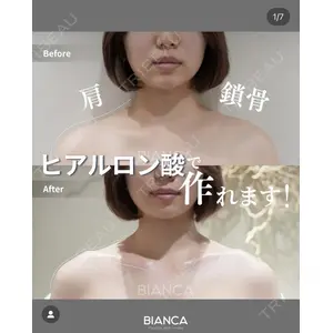 BIANCA表参道 池田 雪太郎医師の症例