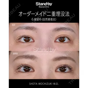 Stand by Beauty Clinic 望月 聖太医師の症例