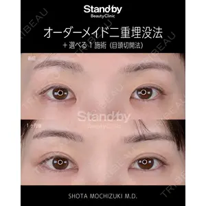Stand by Beauty Clinic 望月 聖太医師の症例