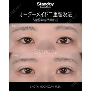 Stand by Beauty Clinic 望月 聖太医師の症例