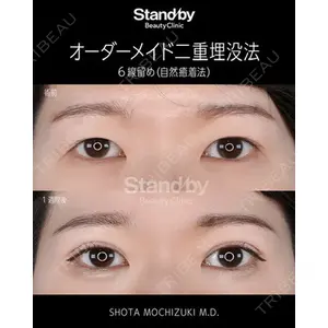 Stand by Beauty Clinic 望月 聖太医師の症例