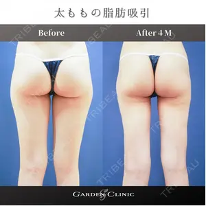 ガーデンクリニック 池袋院の症例
