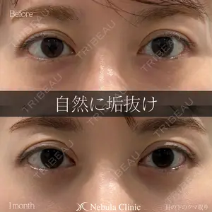 ネビュラクリニック 東京錦糸町院 岩切 琢磨医師の症例