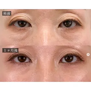 TCB東京中央美容外科 福島院の症例