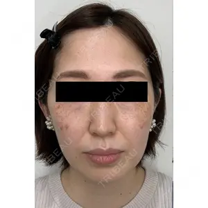 フローラクリニック 秋間雄策（さくちゃん先生）医師の症例
