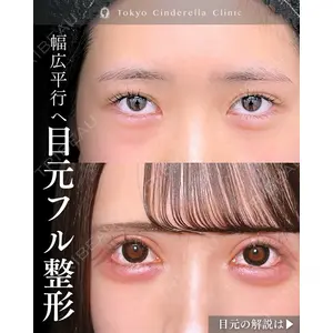 東京シンデレラ美容外科 新宿院 吉原 伯医師の症例