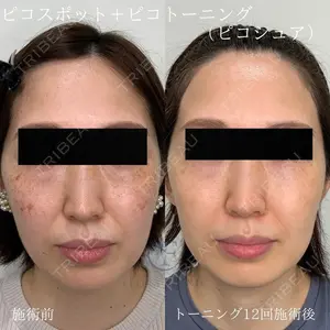 フローラクリニック 秋間雄策（さくちゃん先生）医師の症例